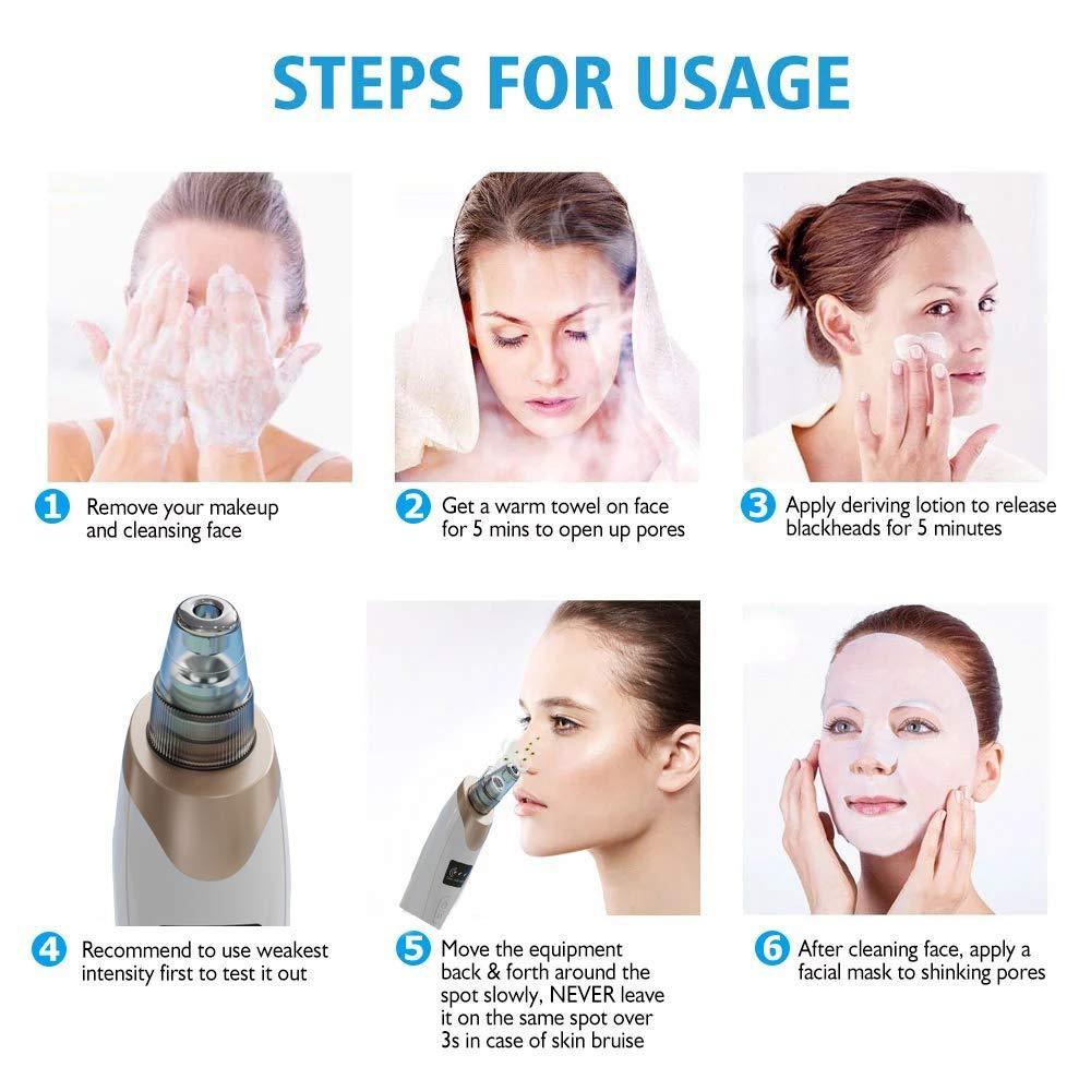 PorePro™ Blackhead Vacuum Cleaner